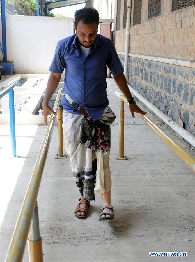 YEMEN-SANAA-DISABLED MEN