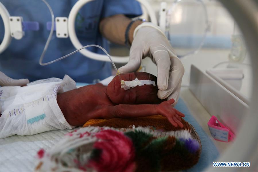 YEMEN-SANAA-WAR-TORN ZONE-BABIES