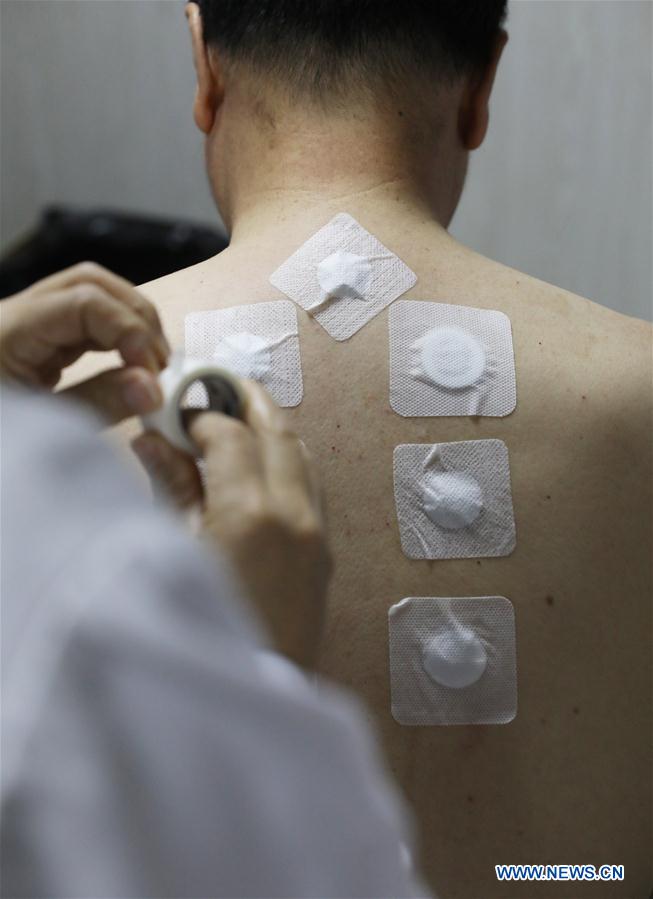 #CHINA-SUMMER-CHINESE MEDICINE-SANFUTIE (CN)